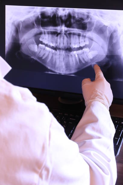 Best Knocked-Out Tooth Emergency  in Vinton, LA