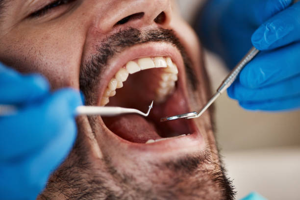 Best Broken Tooth Emergency  in Vinton, LA